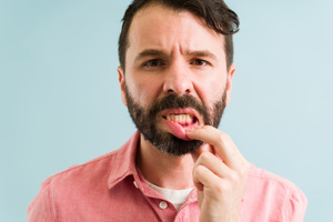 Bearded man pulling down lip to show gum disease