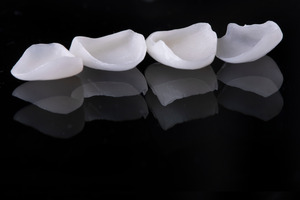 Four veneers lined up in a row on a black surface