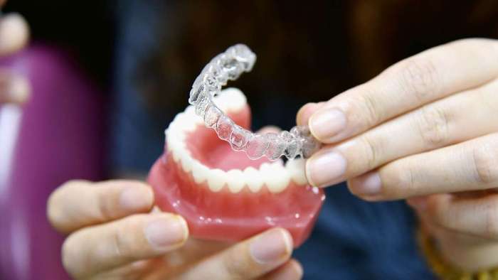 Enhancers Invisalign Invisalign® and Cosmetic Enhancement Story | Invisalign Cary NC